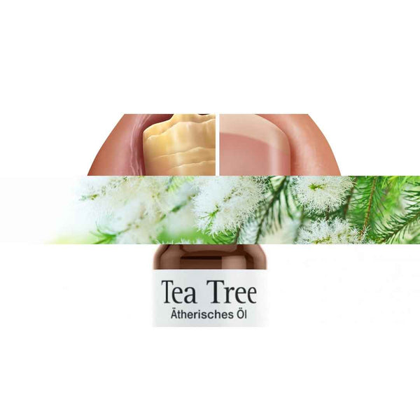 Tea Tree olie tegen schimmelnagels - werkt het?
